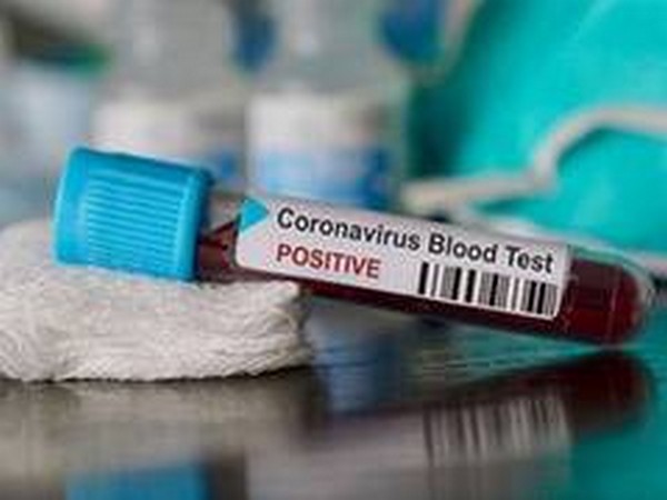 Connecticut coronavirus positive tests spike to 64 pct for one day-governor