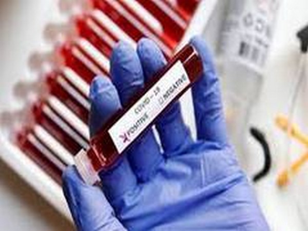 Italy reports 347 coronavirus deaths on Sunday, 14,245 new cases 