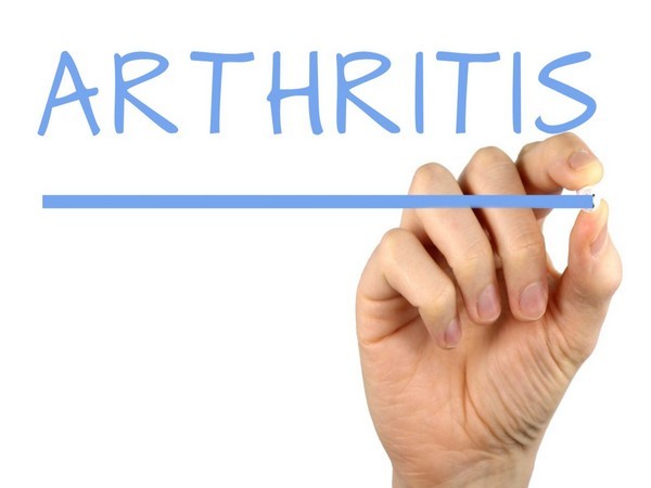 Research examines physical activity, sleep among arthritis patients