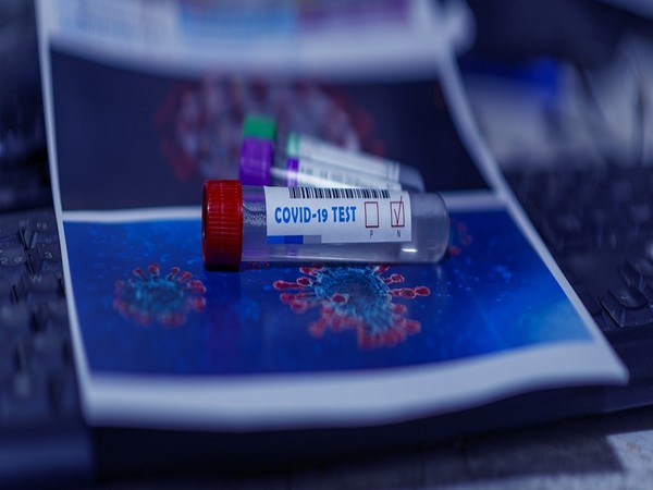 Study reveals blood tests can offer early indicator of severe COVID-19