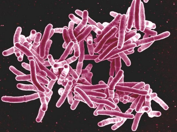 Quarter of world's population at risk of developing tuberculosis: Study