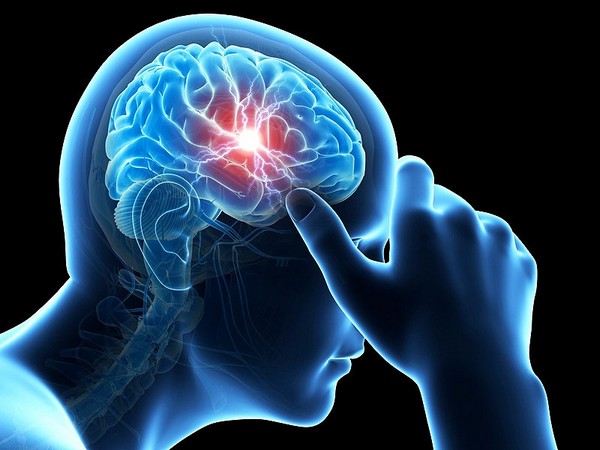 Concussion: almost half of people still show signs of brain injury after six months