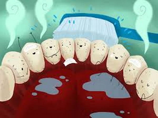 Bacteria causing gum disease can lead to Alzheimer: Study 