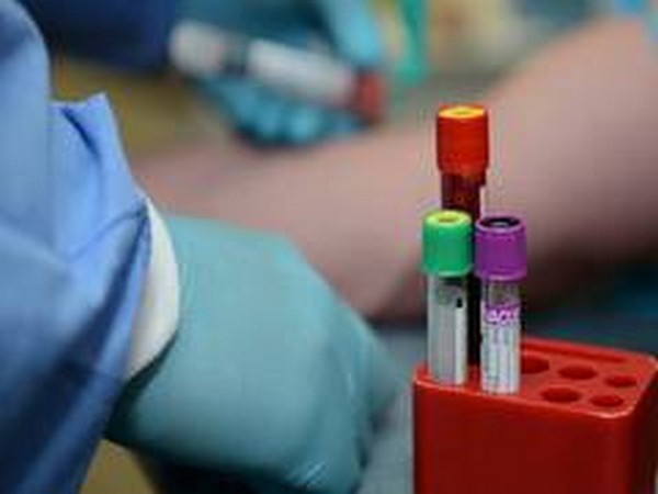 1,352 new coronavirus cases in MP, 12 deaths