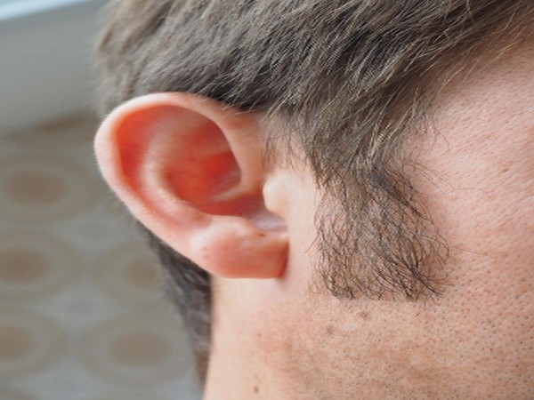 Simpler way to generate sensory hearing cells: Study