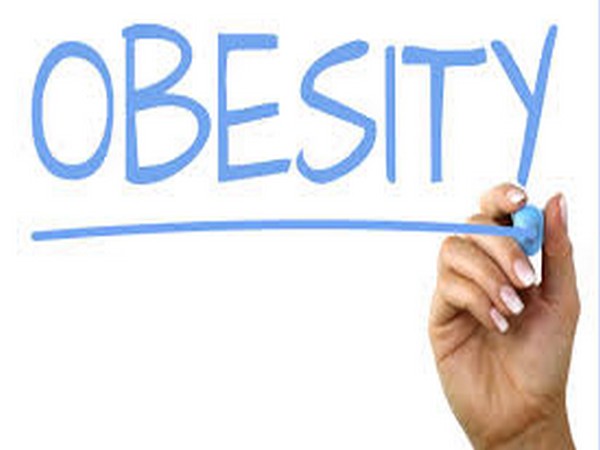 Study backs casual link between obesity and multiple diseases