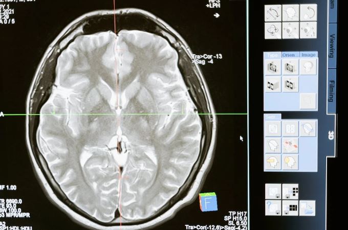 Study establishes direct connection between brain waves, memory