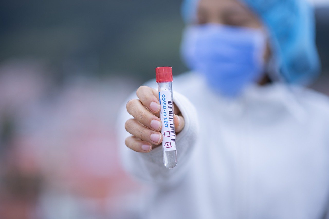 Australian regulator to review price hike in COVID-19 antigen tests 