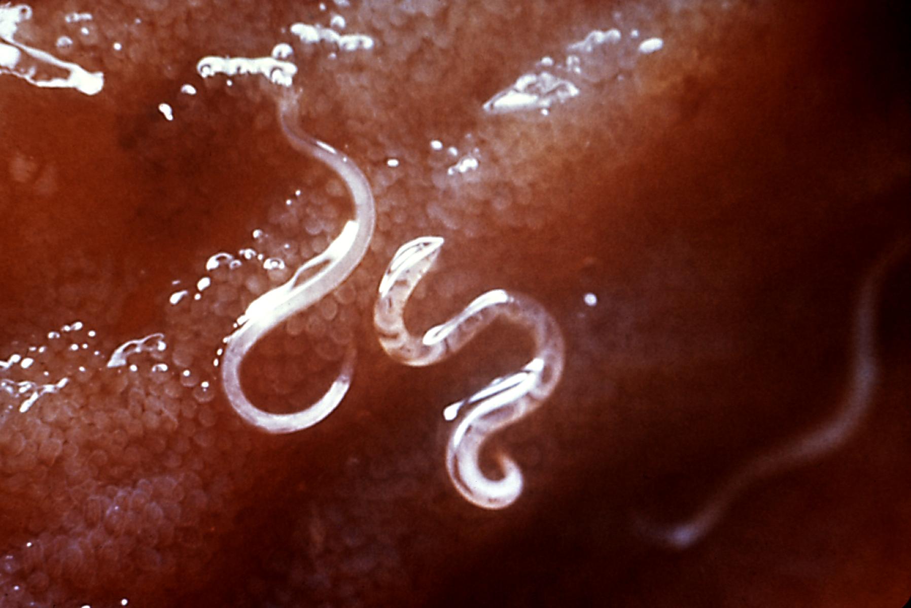 Science News Roundup: Study reveals secrets of parasitic worms; Bill Gates lauds futuristic toilets