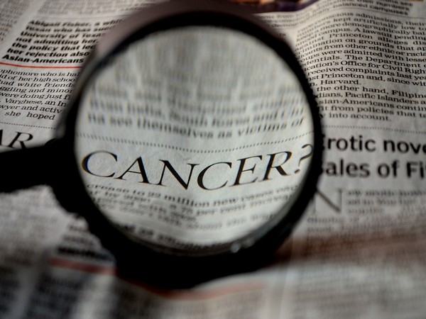 KRAS drug stops cancer growth in preclinical models of pancreatic cancer: Study