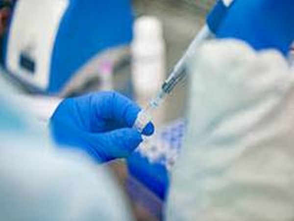 Turkey reports 12,171 new coronavirus cases, 194 deaths