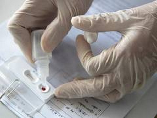 UK sent coronavirus tests to United States for processing -minister