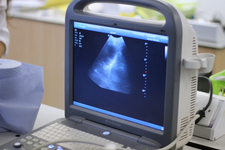 Scientists develop world's smallest ultrasound detector