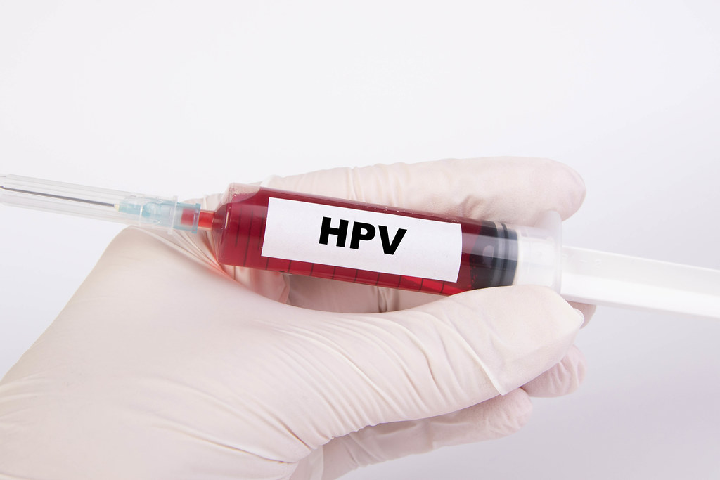 MAC vaccination campaign against human papillomavirus launched in Tanzania
