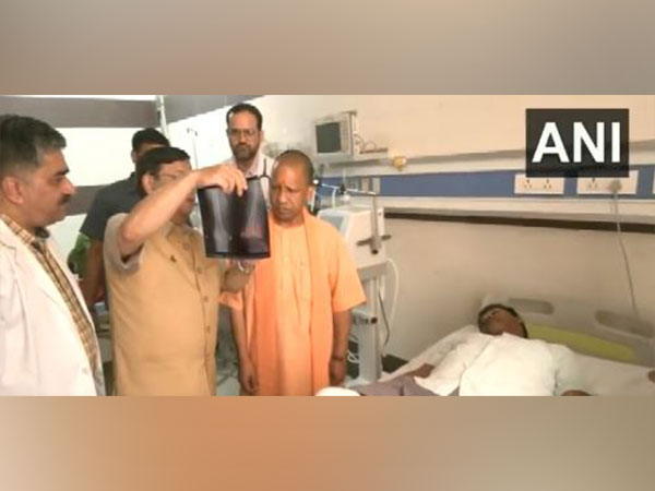 Lucknow court firing: CM Yogi meets injured in hospital