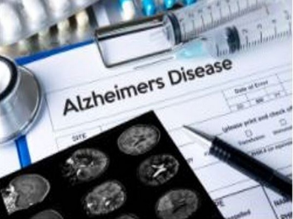Study investigates role of gene associated with Alzheimer's disease in brain's immune cells