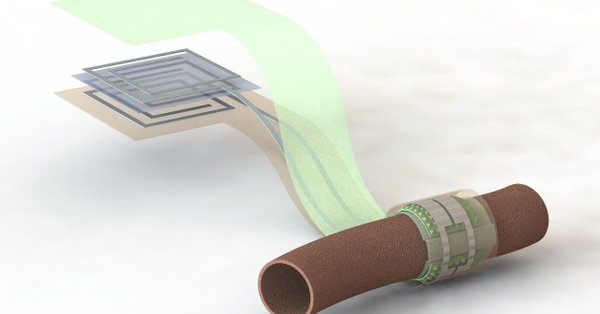 Biodegradable sensor can monitor blood flow in arteries