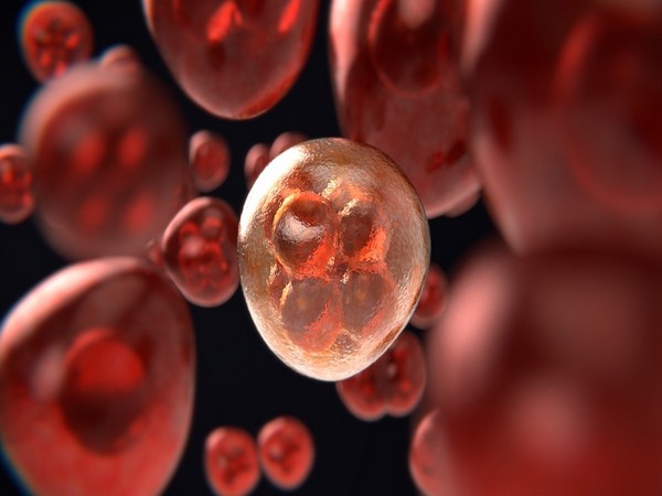 Study suggests lymphoma cell metabolism might provide new cancer target