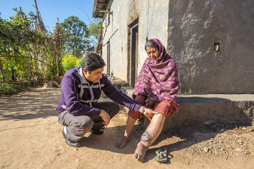 Brazil Eliminates Lymphatic Filariasis as a Public Health Problem, WHO Commends Efforts