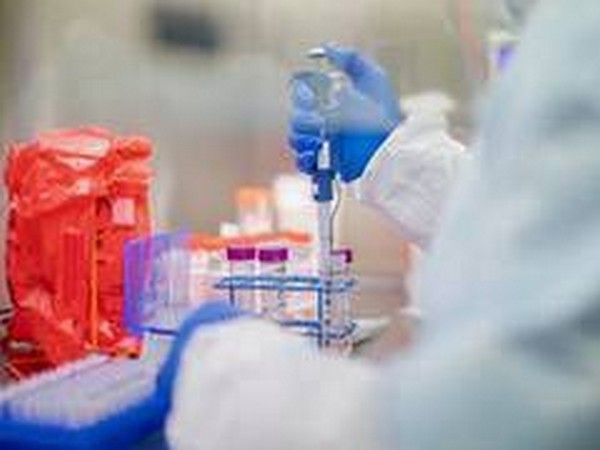 Britain approves Abbott's COVID-19 antibody test