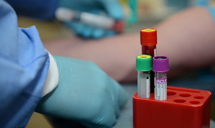 IIT Kharagpur researchers develop low-cost blood test device