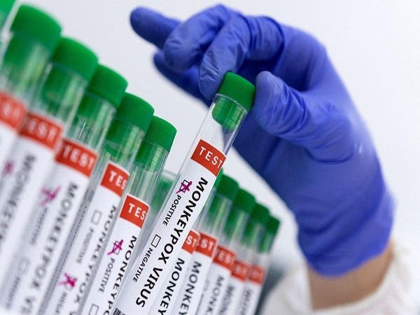 Monkeypox: All 15 samples from Maharashtra test negative