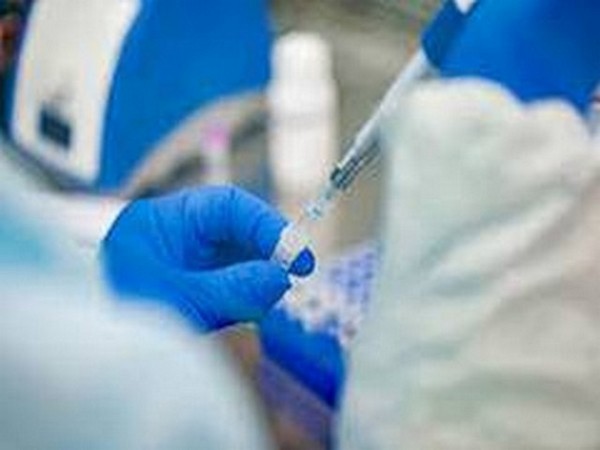 Italy reports 36 coronavirus deaths on Monday, 907 new cases