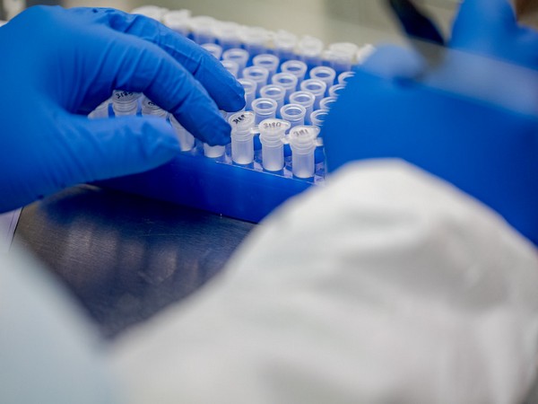 UAE registers new daily coronavirus high amid increased testing