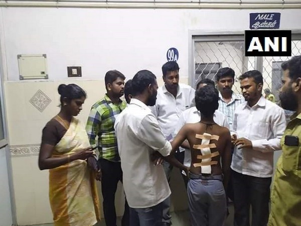 TN: Madurai student makes casteist slurs at classmate, attacks with blade on back