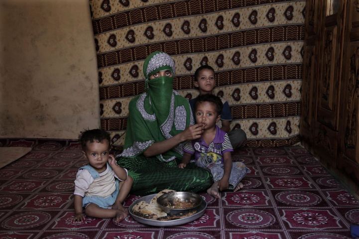 Yemen war throwing girls into extreme form of malnutrition 