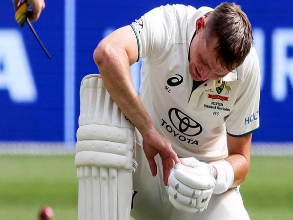 Australia batter Marnus Labuschagne to undergo scan after copping blow to his finger