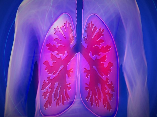 Scientists find potential diagnostic and therapeutic target for lung cancer