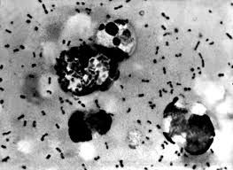 CORRECTED-China reports fourth case of plague this month