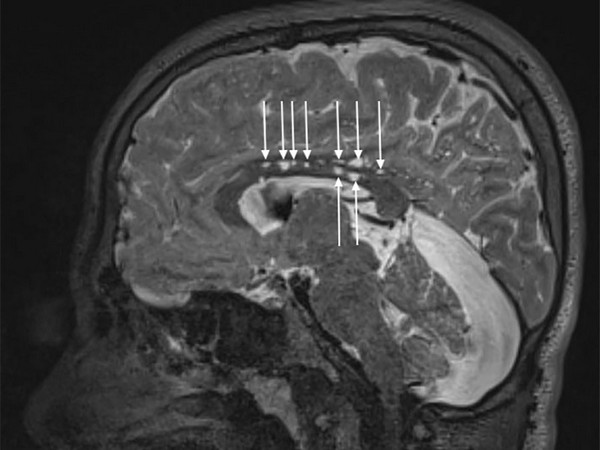 Brain magnetic resonance imaging enhanced through artificial intelligence: Study