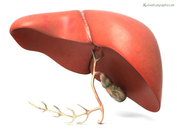 Study examines development of fatty liver disease under healthy diet