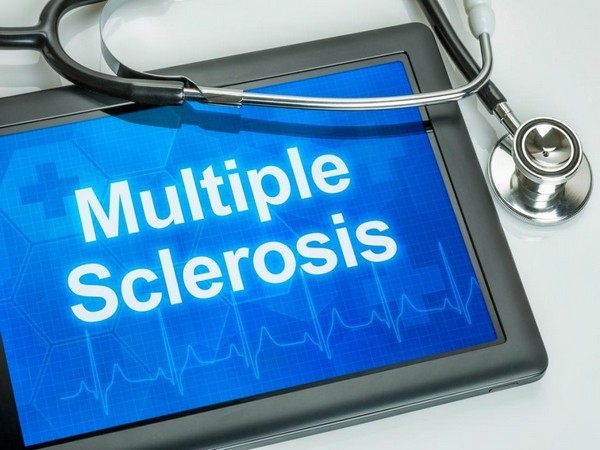 Study finds Epstein-Barr virus might be leading cause of multiple sclerosis