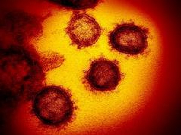 Nigeria confirms first fatality from coronavirus -NCDC