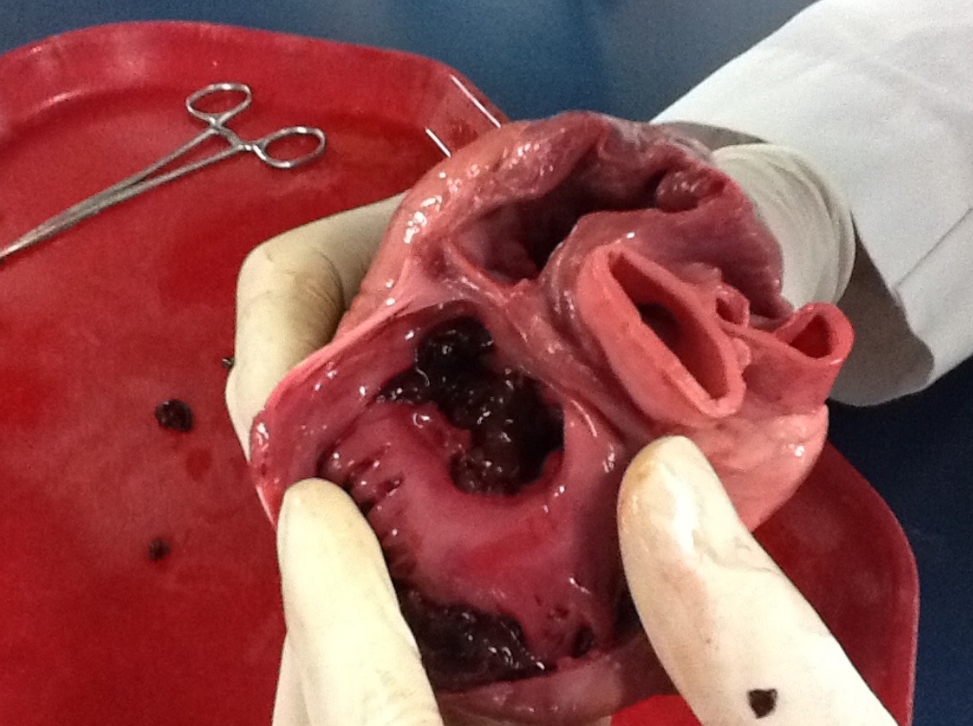 Study claims 3D-printed vascular networks can develop artificial organs 