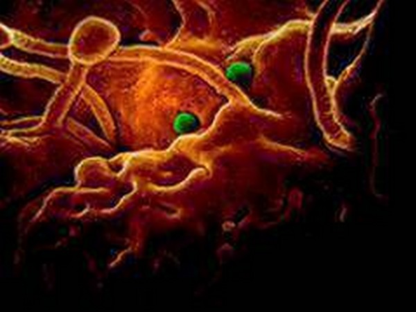UPDATE 2-Switzerland confirms first case of coronavirus