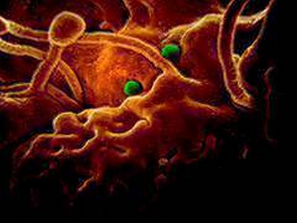UPDATE 3-Italy battles surging coronavirus outbreak as cases rise over 100