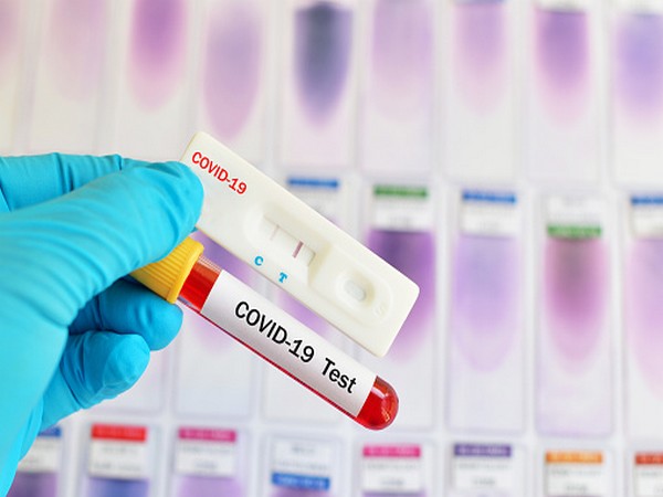 Home testing kits may give false negative reports even after having COVID symptoms: Expert