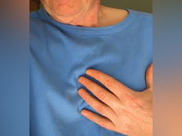 US study reports decline in heart attacks greater among men than women