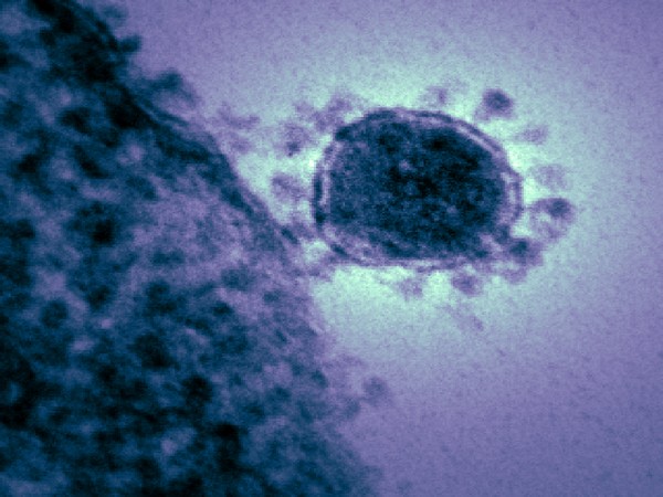 One person with new coronavirus visited Mexico, has left country - statement