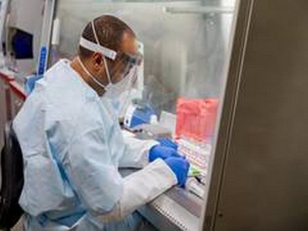 Brazil university in talks to test Italian coronavirus vaccine