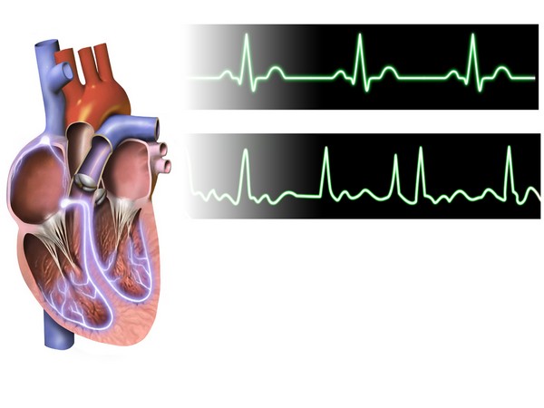 How COVID affects the heart, according to a cardiologist