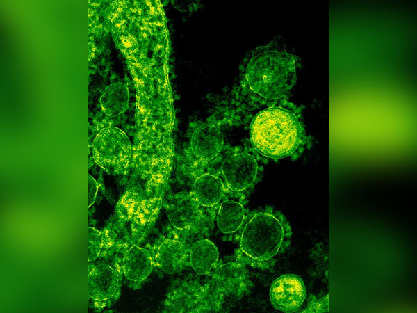 Multiple sclerosis: new evidence for the role of glandular fever virus
