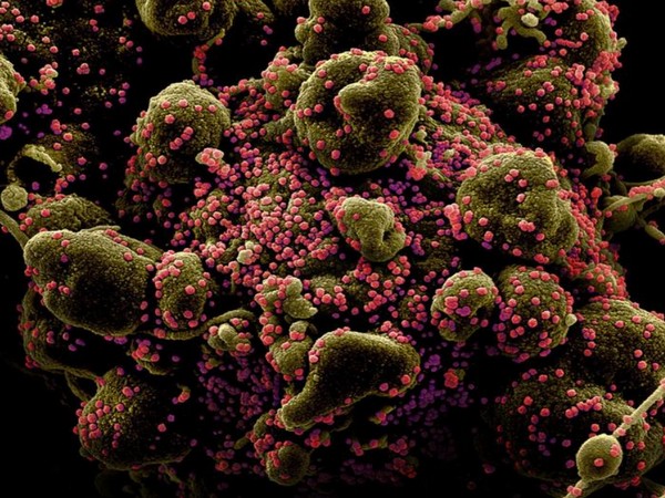 Switzerland virus cases top 10,000
