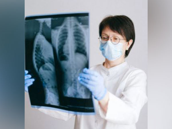 COVID-19 can cause lasting lung damage – 3 ways long COVID patients’ respiration can suffer