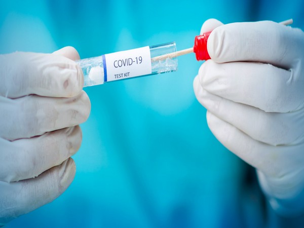 COVID-19 cases rise for first time in seven weeks: WHO
