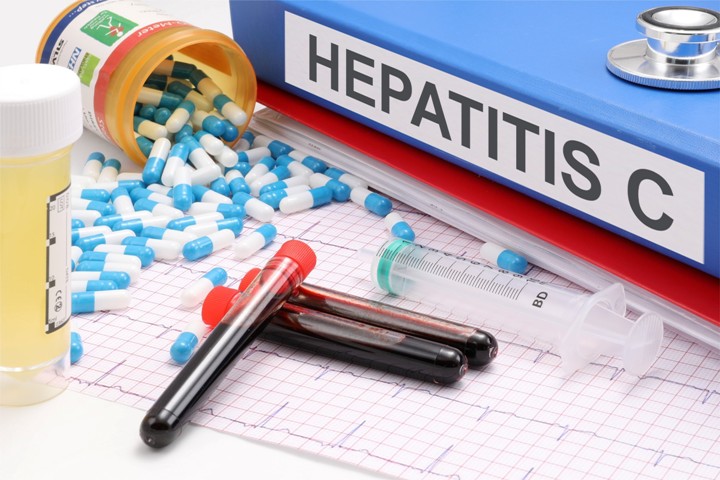 Health News Roundup: Few U.S. patients with hepatitis C get timely treatment, CDC says; UK faces danger of running out of monkeypox vaccine by this month - FT and more 